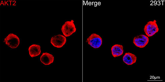 AKT2 Rabbit mAb