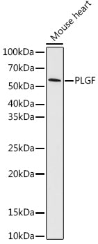 PLGF Rabbit mAb
