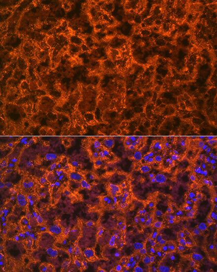 PLGF Rabbit mAb