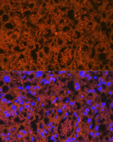 PLGF Rabbit mAb