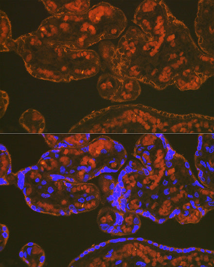 PLGF Rabbit mAb