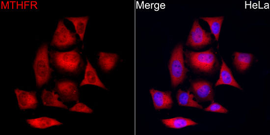 MTHFR Rabbit mAb