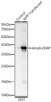 Amylin/DAP Rabbit mAb