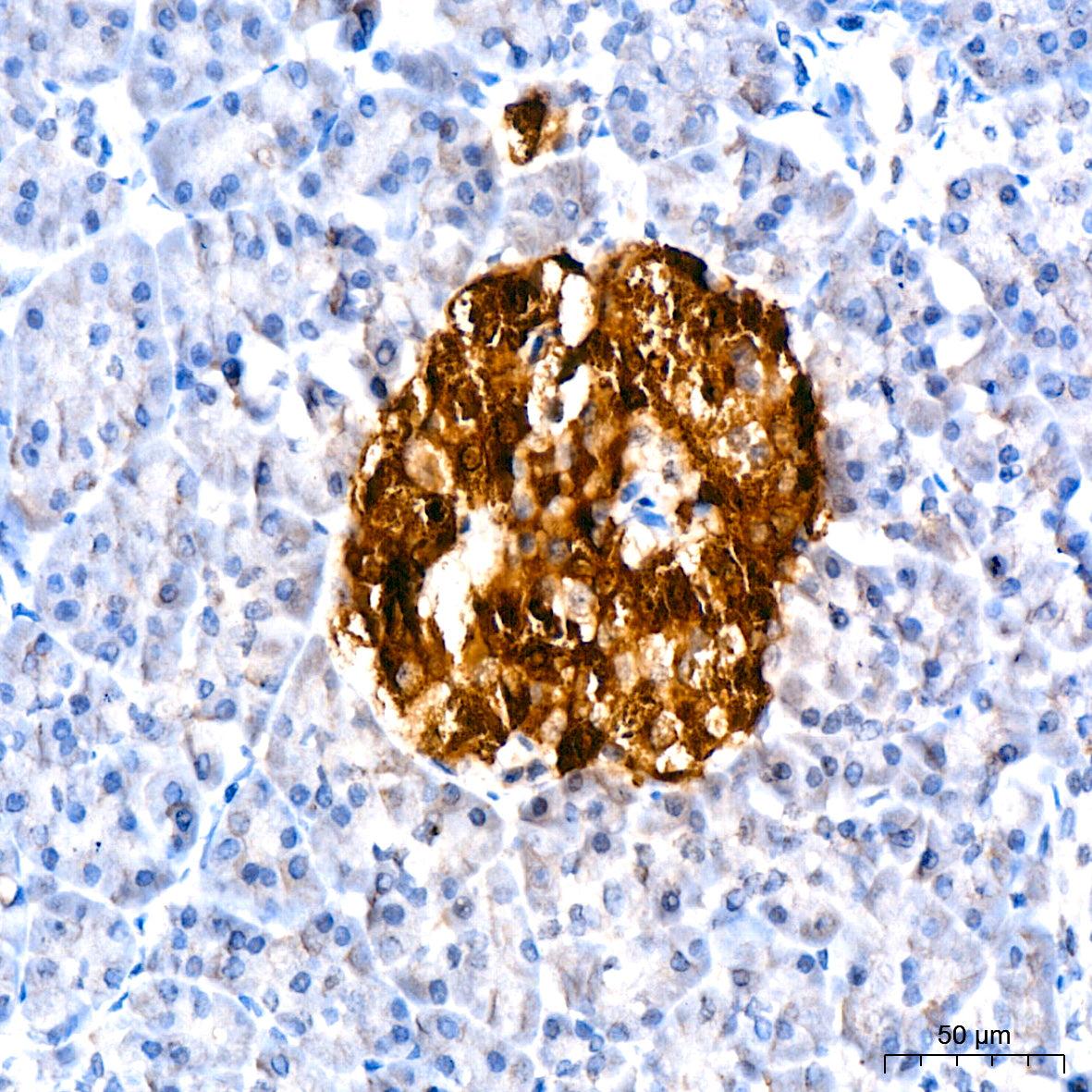 Amylin/DAP Rabbit mAb