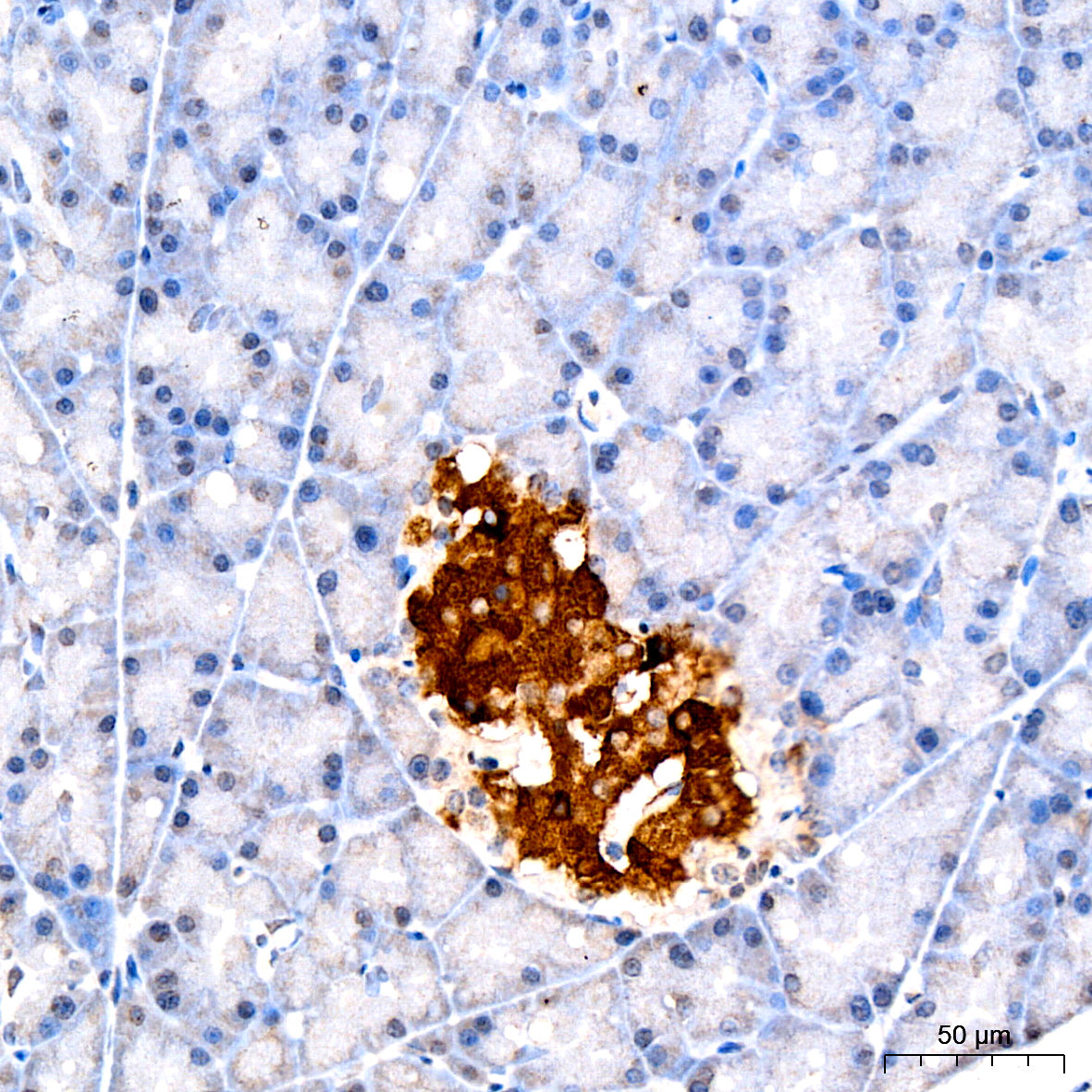Amylin/DAP Rabbit mAb