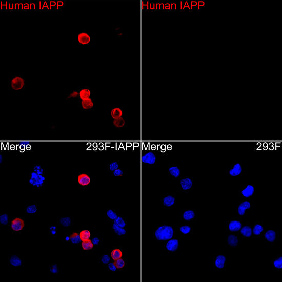 Amylin/DAP Rabbit mAb