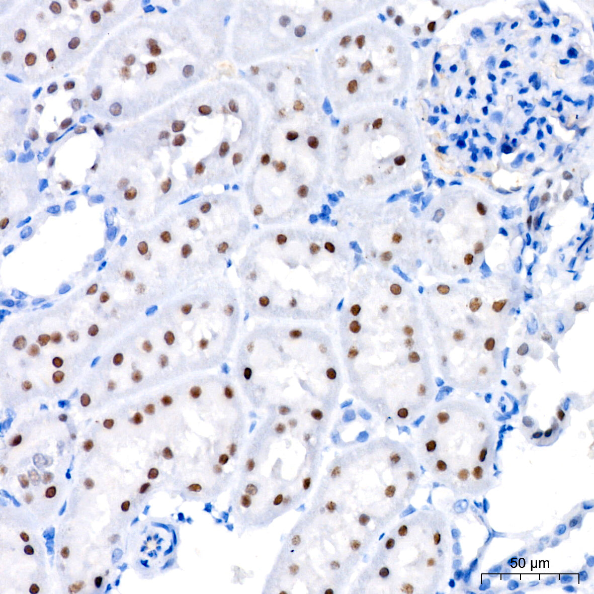FXR/NR1H4 Rabbit mAb