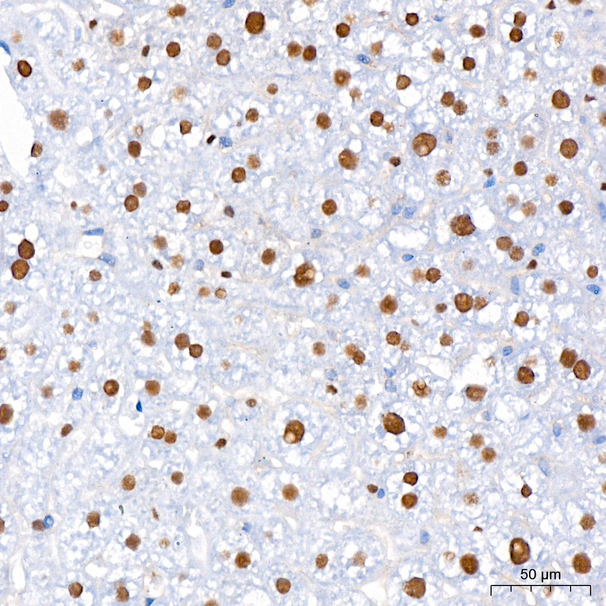 FXR/NR1H4 Rabbit mAb