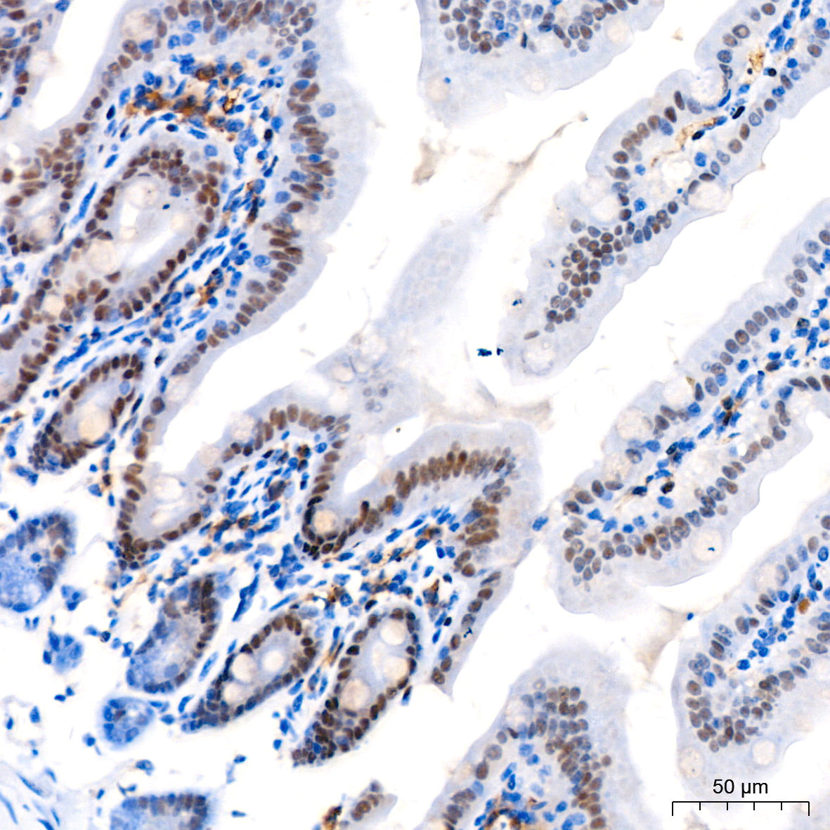 FXR/NR1H4 Rabbit mAb