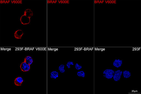 BRAF V600E Rabbit mAb