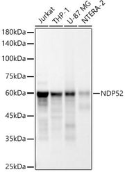[KD Validated] NDP52 Rabbit mAb
