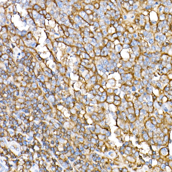 CD44 Rabbit mAb