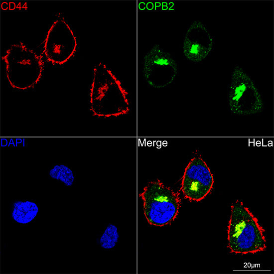 CD44 Rabbit mAb