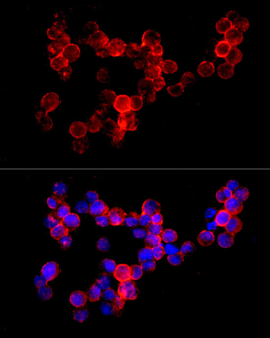 CD74 Rabbit mAb