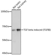 TGF beta induced (TGFBI) Rabbit mAb