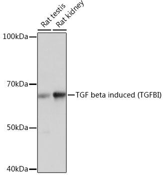 TGF beta induced (TGFBI) Rabbit mAb