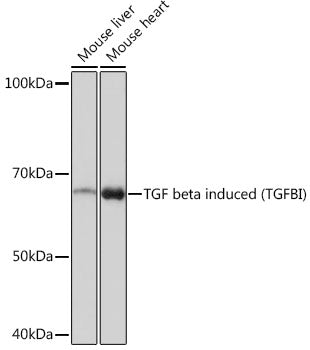 TGF beta induced (TGFBI) Rabbit mAb