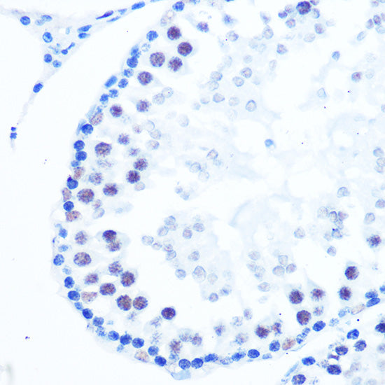 DNA Polymerase beta Rabbit mAb