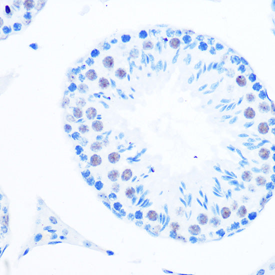 DNA Polymerase beta Rabbit mAb