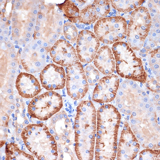 Alpha Fodrin Rabbit mAb
