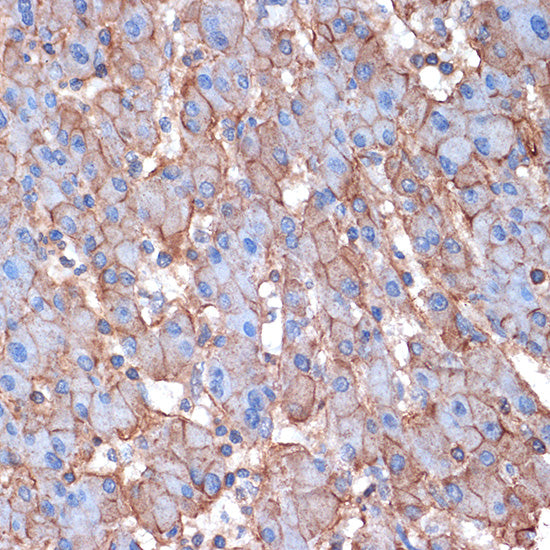 Alpha Fodrin Rabbit mAb