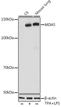 MDA5 Rabbit mAb