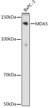 MDA5 Rabbit mAb