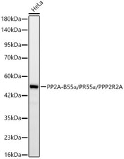 PP2A-B55α/PR55α/PPP2R2A Rabbit mAb