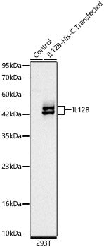 IL12B Rabbit mAb