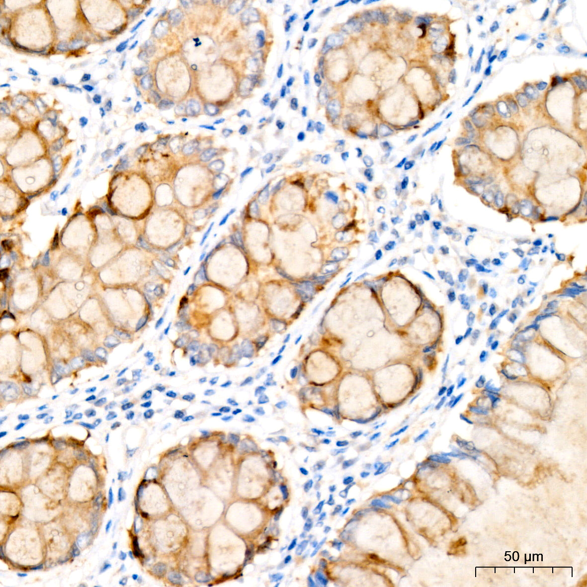 IL12B Rabbit mAb
