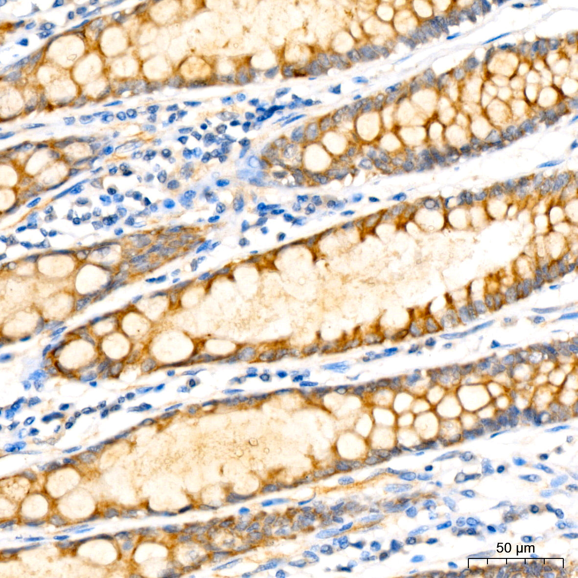 IL12B Rabbit mAb