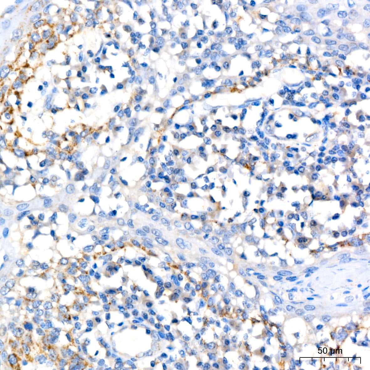 IL12B Rabbit mAb