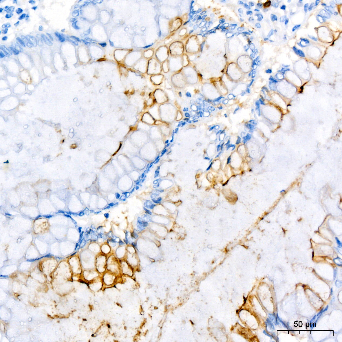 CD177 Rabbit mAb