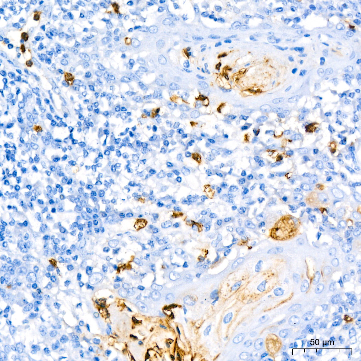 CD177 Rabbit mAb