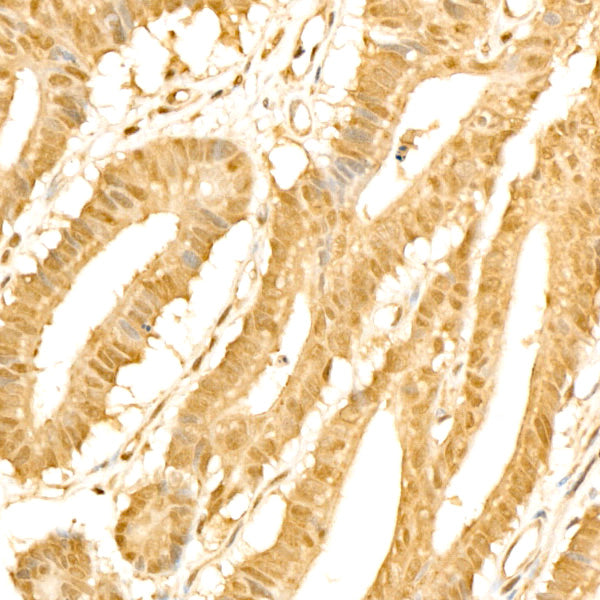 PPP1CA Rabbit mAb