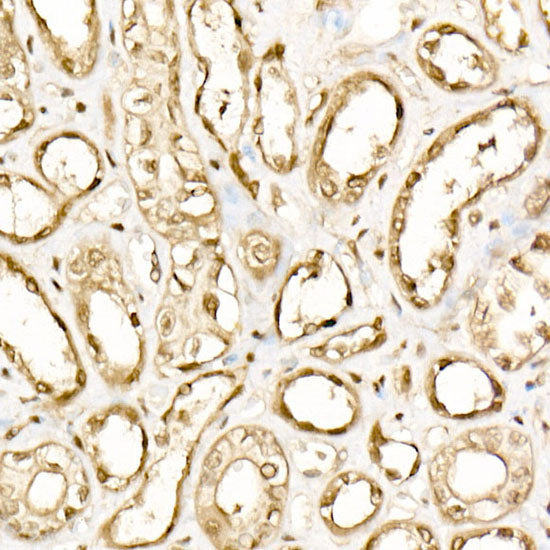 EIF4A1/EIF4A2/EIF4A3 Rabbit mAb