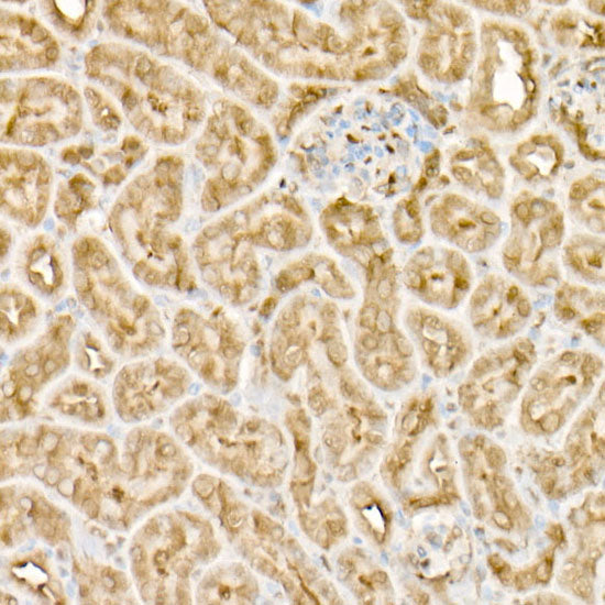 EIF4A1/EIF4A2/EIF4A3 Rabbit mAb