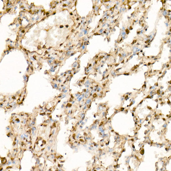 EIF4A1/EIF4A2/EIF4A3 Rabbit mAb