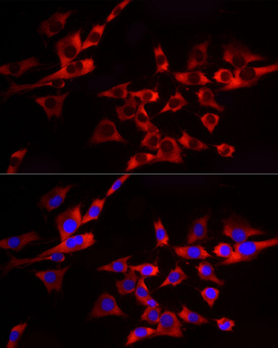 EIF4A1/EIF4A2/EIF4A3 Rabbit mAb