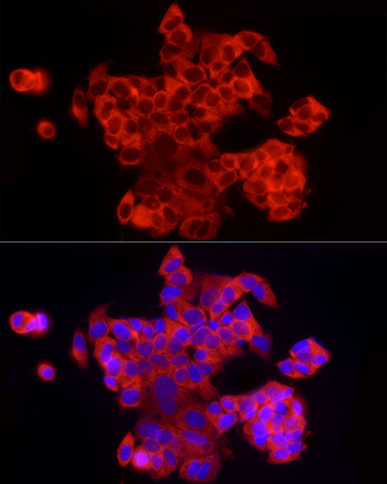 EIF4A1/EIF4A2/EIF4A3 Rabbit mAb