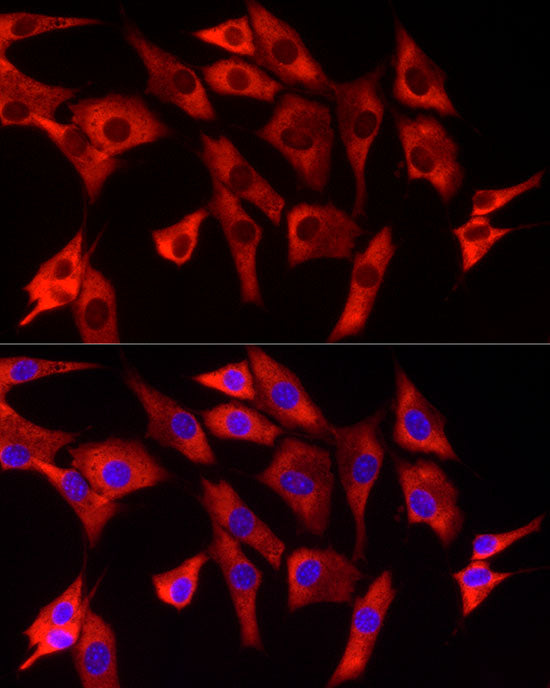 EIF4A1/EIF4A2/EIF4A3 Rabbit mAb