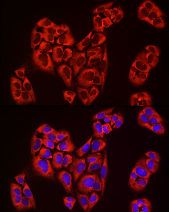 EIF4A1/EIF4A2/EIF4A3 Rabbit mAb