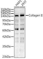 Collagen II Rabbit pAb