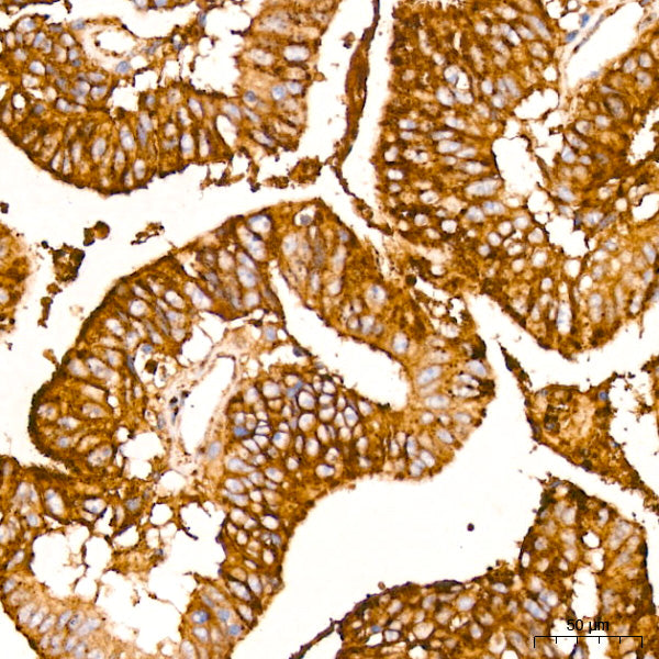 IFITM3 Rabbit mAb