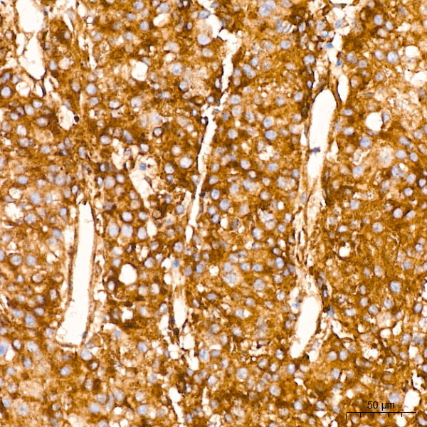 IFITM3 Rabbit mAb