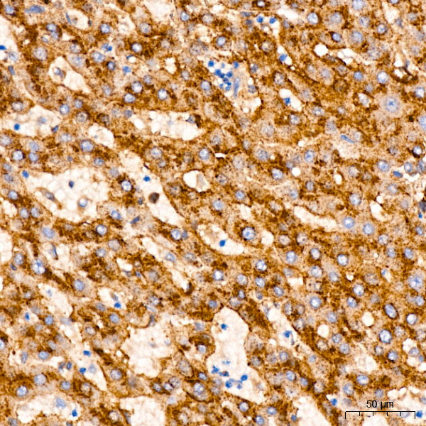 IFITM3 Rabbit mAb