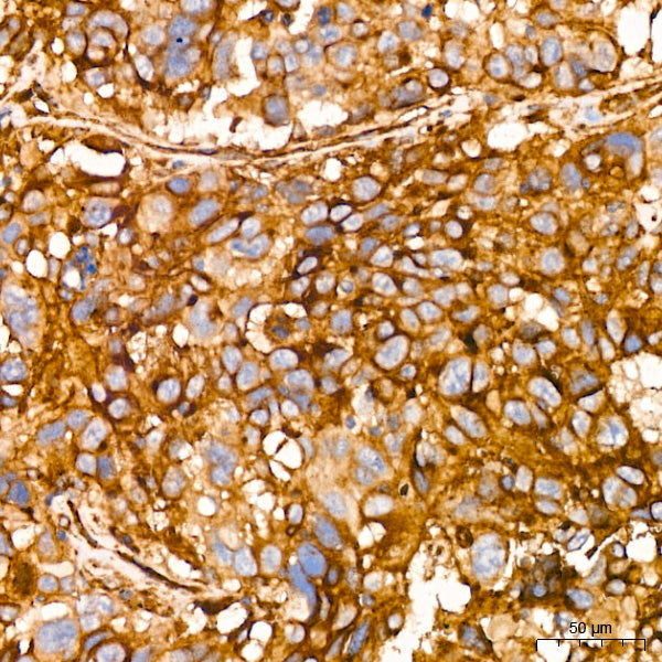 IFITM3 Rabbit mAb