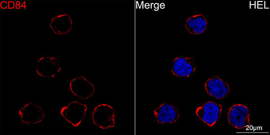 CD84 Rabbit mAb