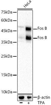 Fos B Rabbit mAb
