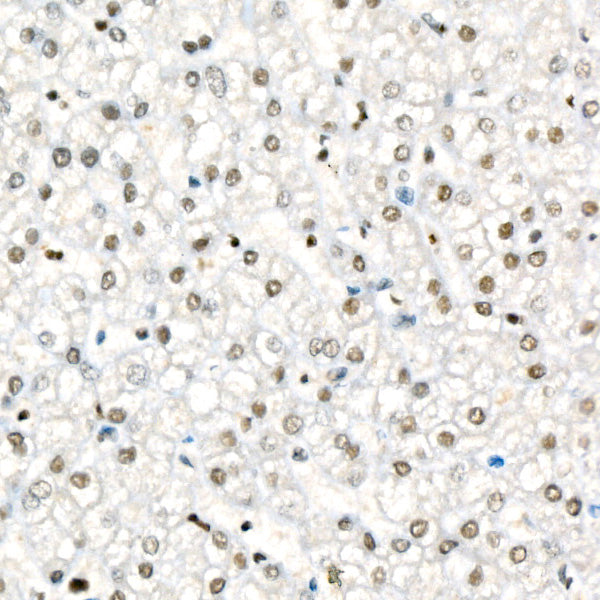 Fos B Rabbit mAb
